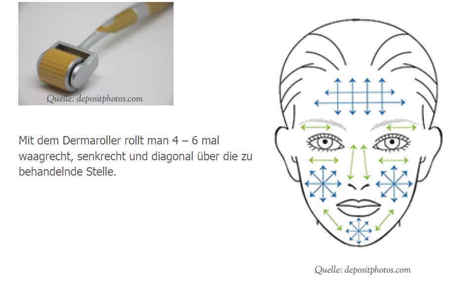 Dermaroller