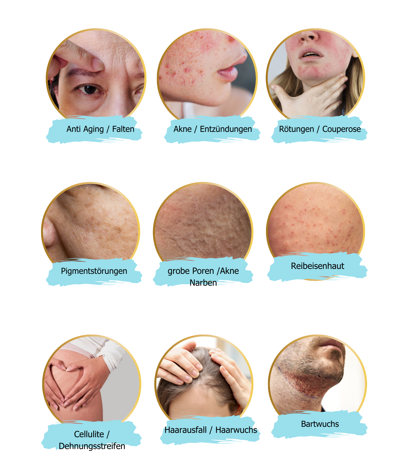Microneedling Schulung mit Video